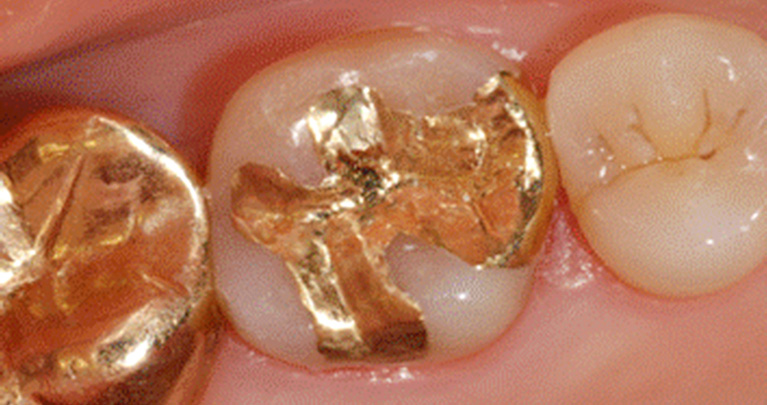 mplant_Dental_Clinic_img10