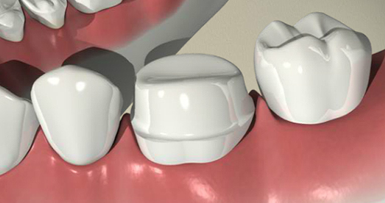 mplant_Dental_Clinic_img2