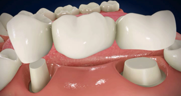 mplant_Dental_Clinic_img3