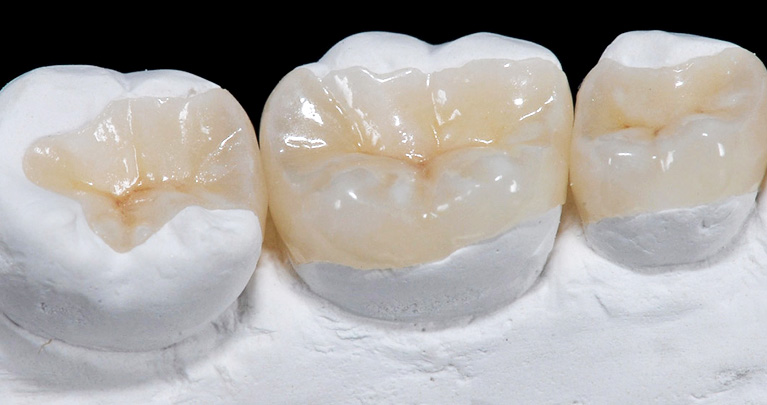 mplant_Dental_Clinic_img4