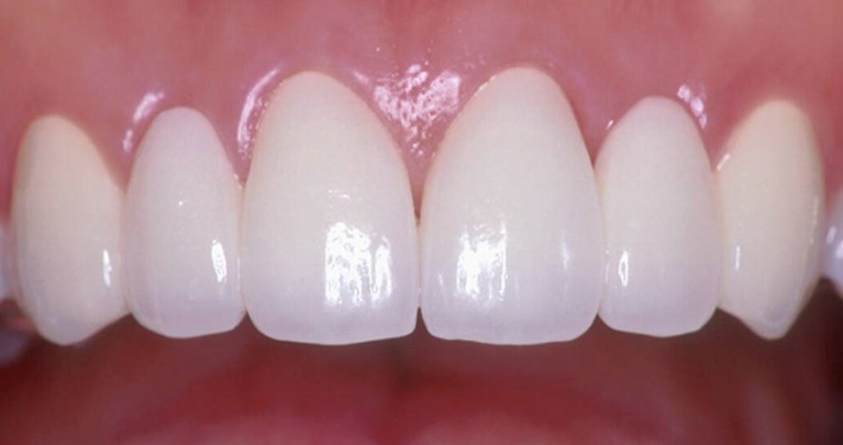 Mplant Dental Clinic Img5
