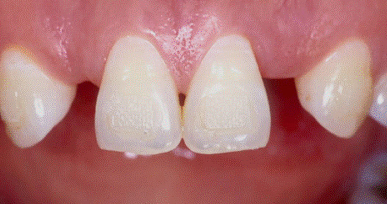 mplant_Dental_Clinic_img6