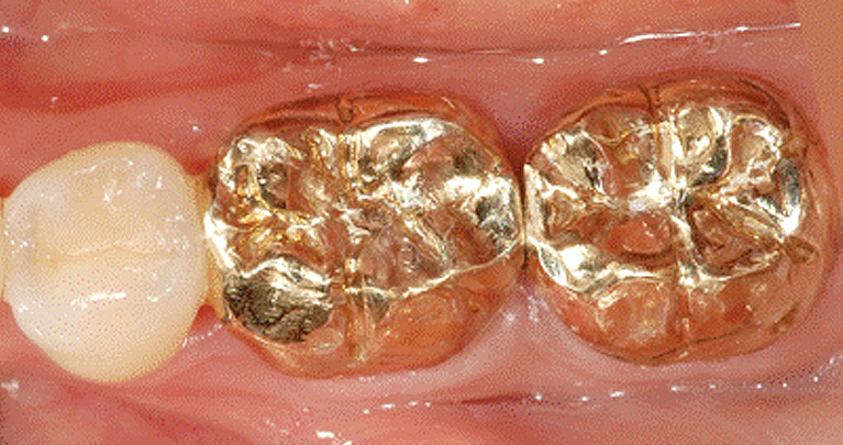mplant_Dental_Clinic_img8