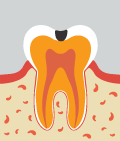 mplant_dental_img_03_01