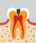 mplant_dental_img_03_02