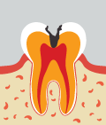 mplant_dental_img_03_03