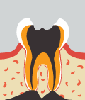 mplant_dental_img_03_04