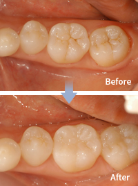 mplant_dental_img_04_01