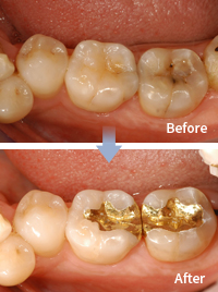 mplant_dental_img_04_02
