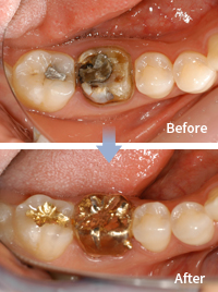 mplant_dental_img_04_03