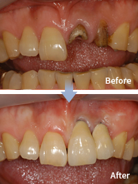 mplant_dental_img_04_04