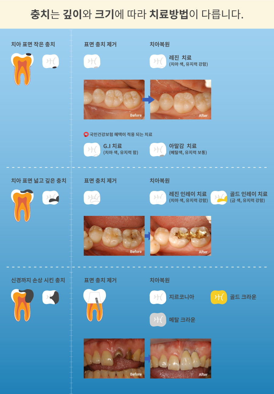 mplant_dental_imgl_03