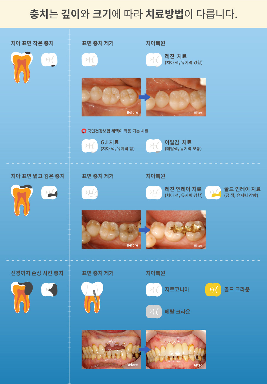mplant_dental_imgl_03_2