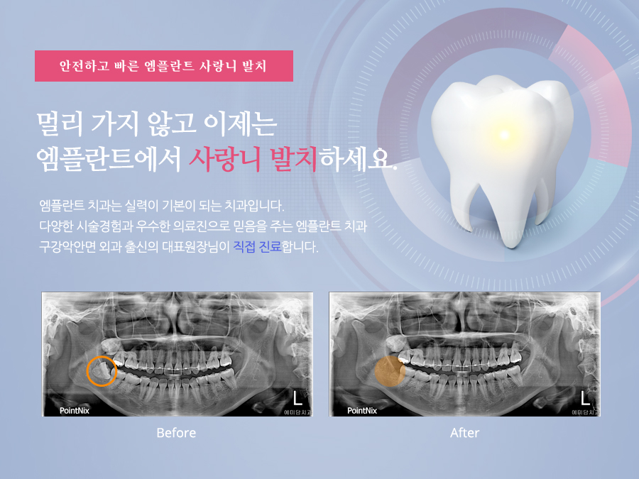 mplant_dental_imgl_09