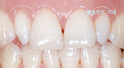 mplant_laminate_img2
