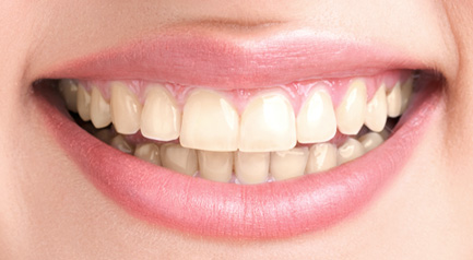 Mplant Whitening Img2