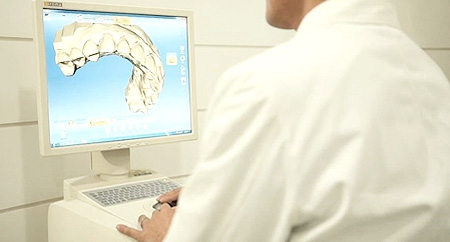 mplant_implant_img4