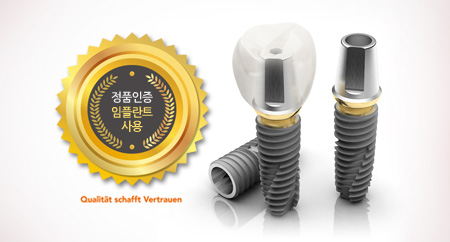 mplant_implant_img5