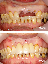 mplant_dental_img_04_04